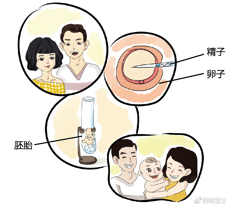 流产坐月子