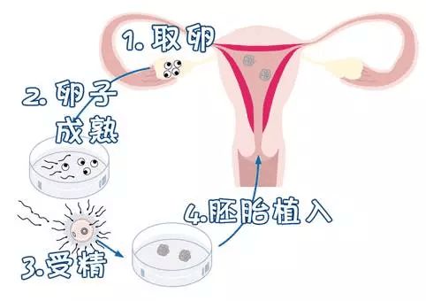 泸水捐卵费用