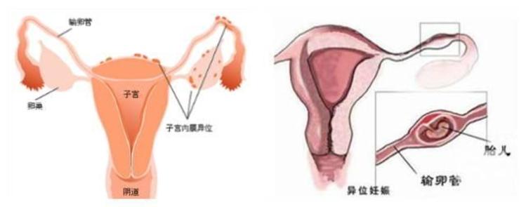 泰安不孕不育医院
