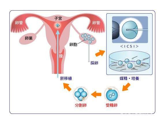 泰国试管婴儿
