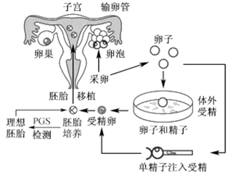 泰安捐卵试管生男孩