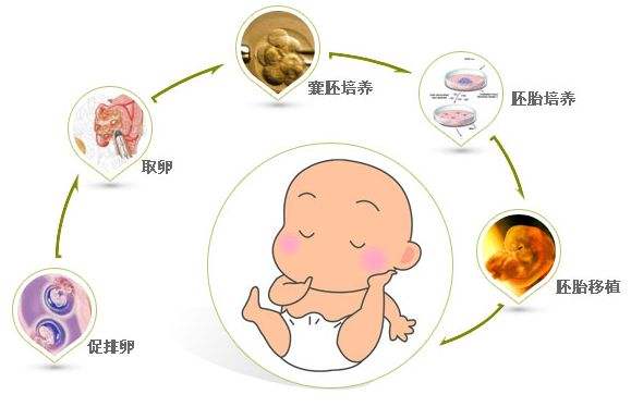 泸州试管婴儿