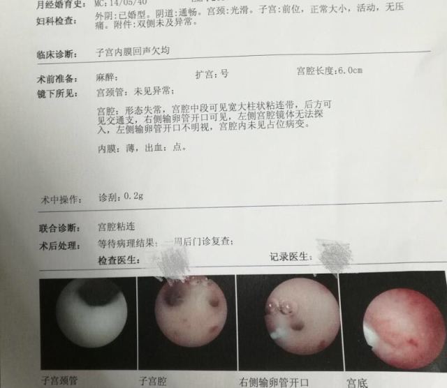 泰国试管婴儿