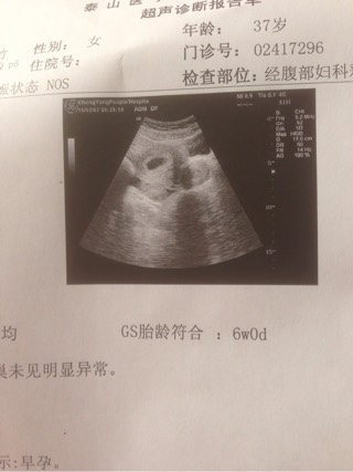 泰国试管婴儿