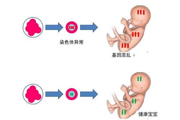 泰国试管婴儿