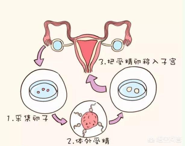 济南代怀孕捐卵有哪些