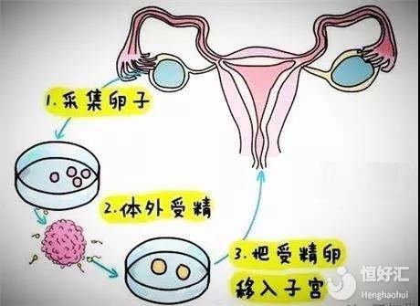 怀孕测试
